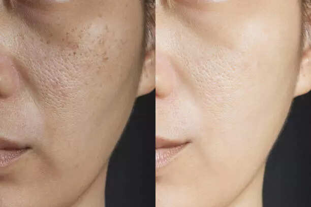 5 foods which are rich in Glutathione and brilliant for your skin