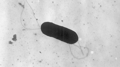 US Listeria Outbreak: California company removes food from shelves after 10 hospitalised