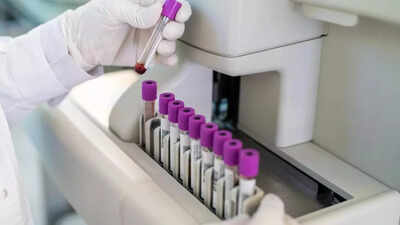 Alzheimer’s Disease: FDA greenlights first-of-its-kind blood test for Alzheimer’s disease: How does it work? |